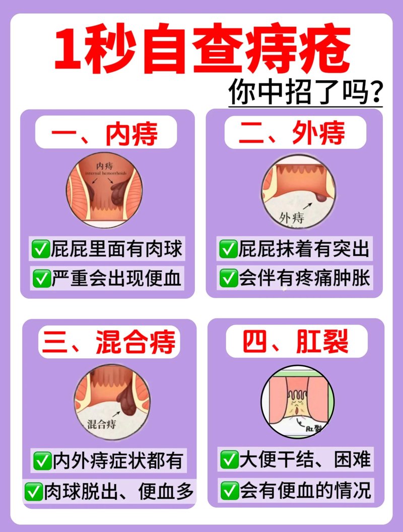 内痔外痔