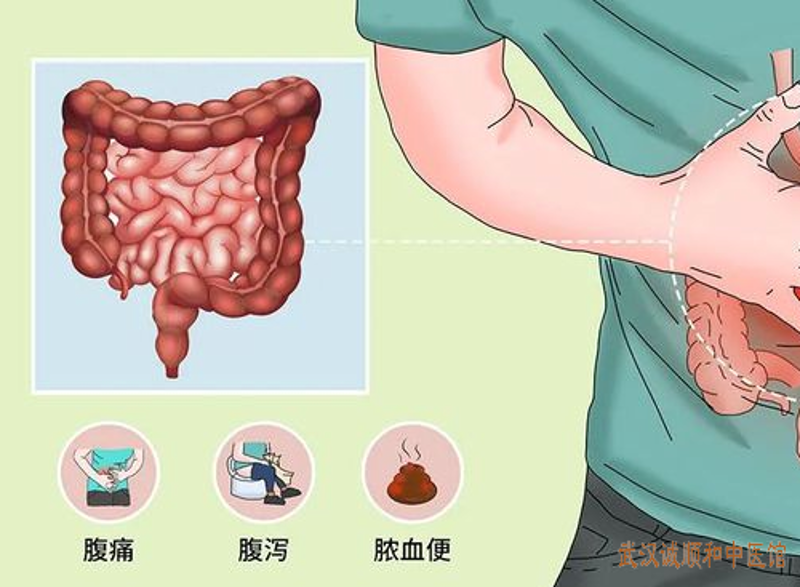 肠炎调理